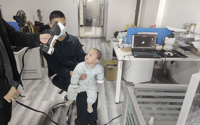 3D Scanning Baby's Head