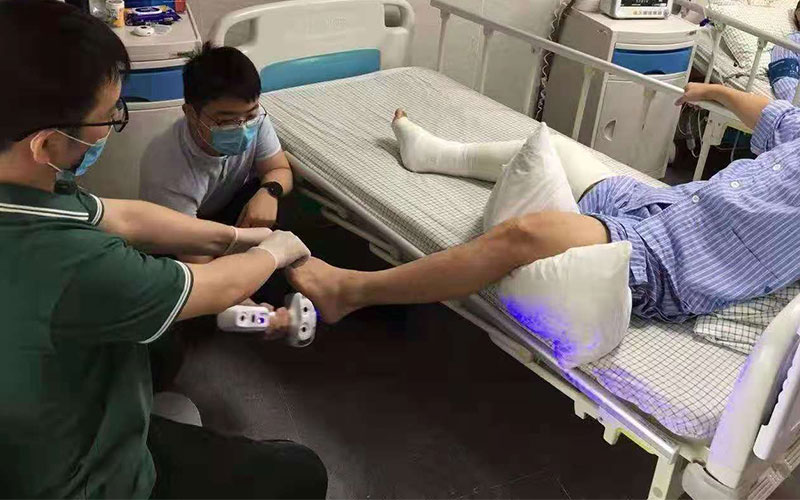 iReal 2e 3d scanning injured leg