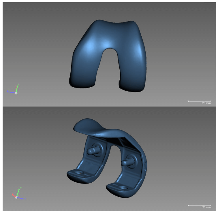 3D data of knee implant-1