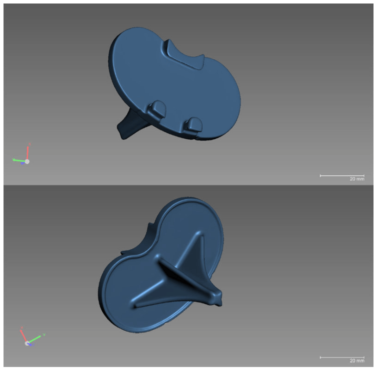 3D data of knee implant