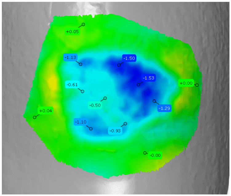 Trauma area 3D analysis