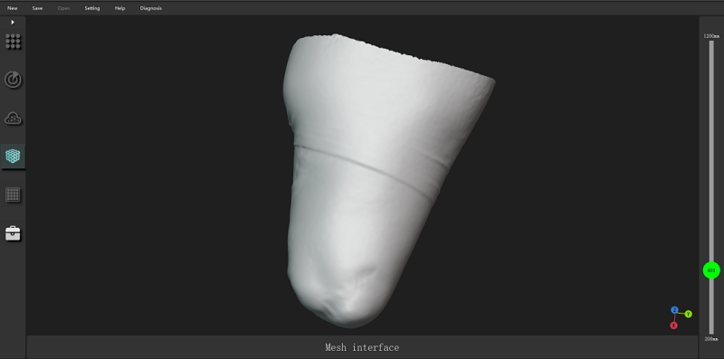 3D Scan Data of Residual Limb