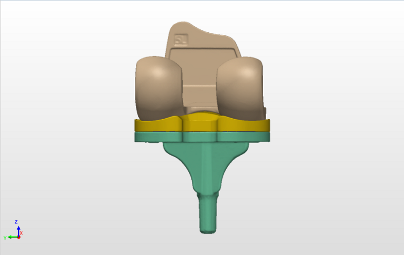 Artificial Knee Joint Component Scanning Data