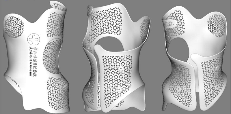 Designing a Form-fitting and Breathable Brace Based on 3D Data