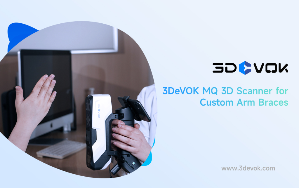 Revolutionizing Digital Healthcare with 3DeVOK MQ 3D Scanner: Precision 3D Scanning for Custom Arm Braces